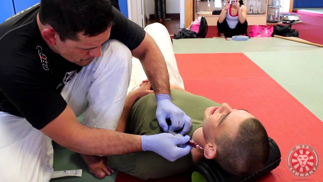 Death of the Cauliflower Ear